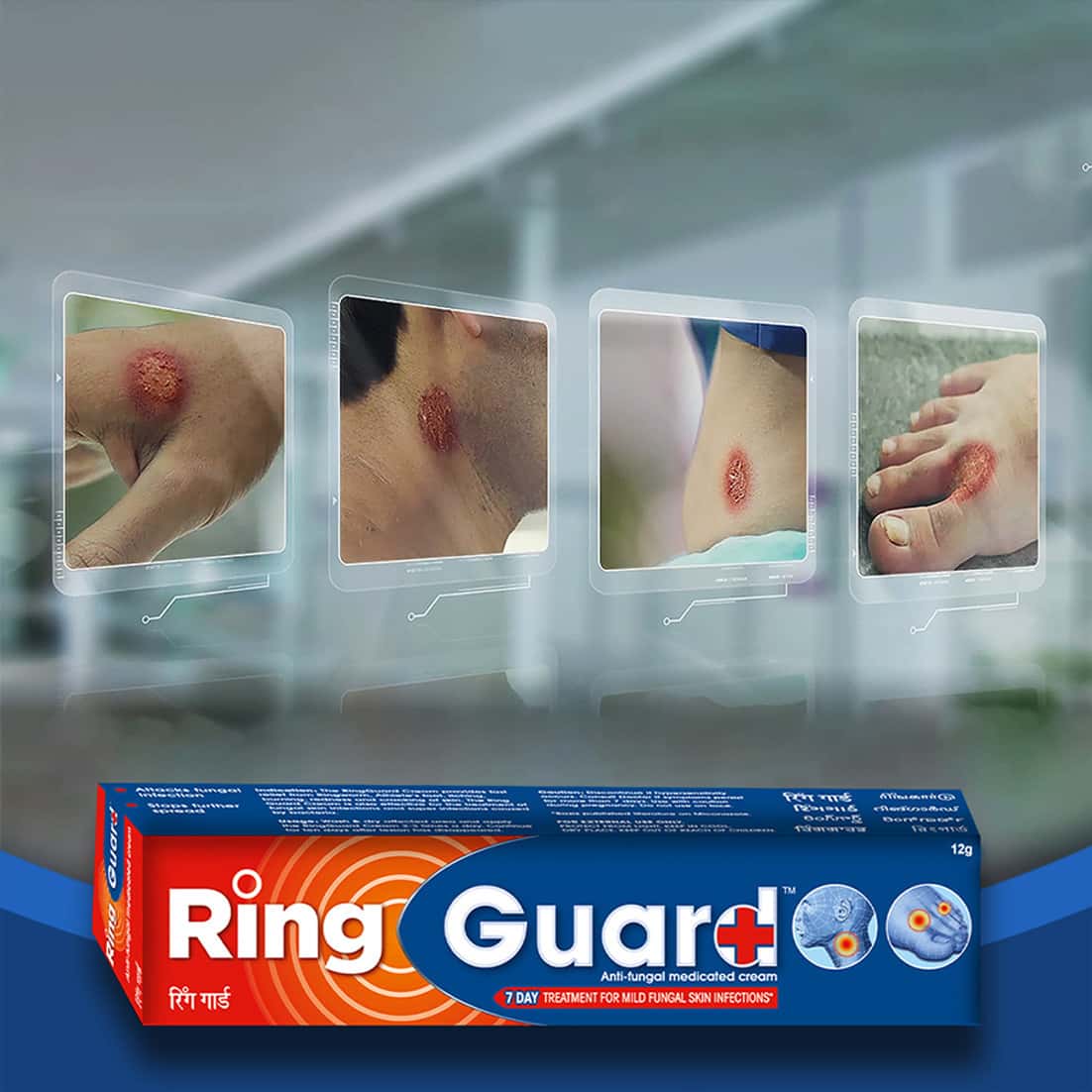 Ring Guard
